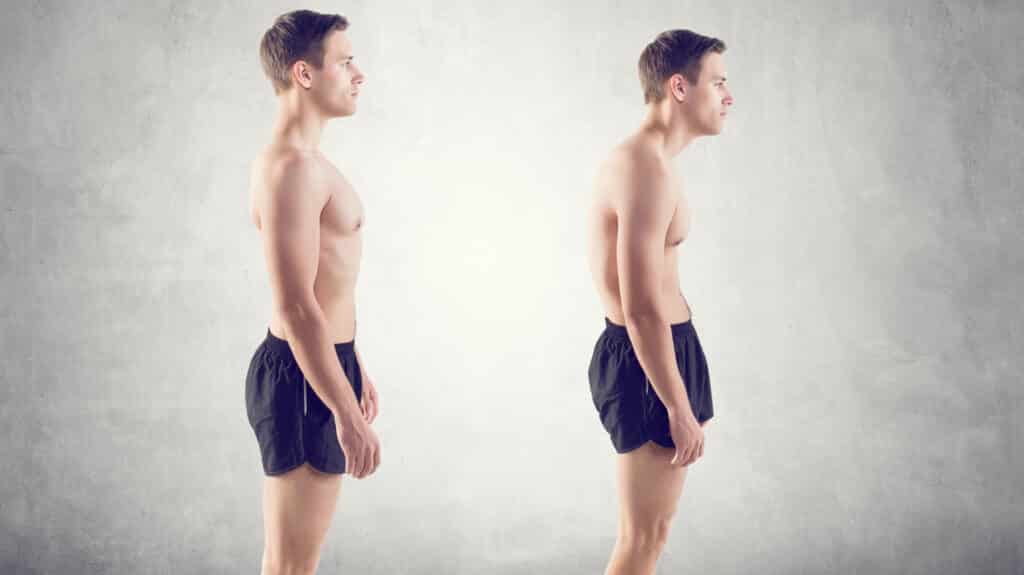 Do Chiropractors Help With Fixing Bad Posture?