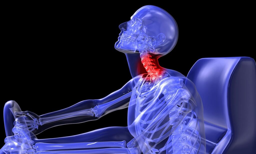 Chiropractic Care for Whiplash Injury in Chicago