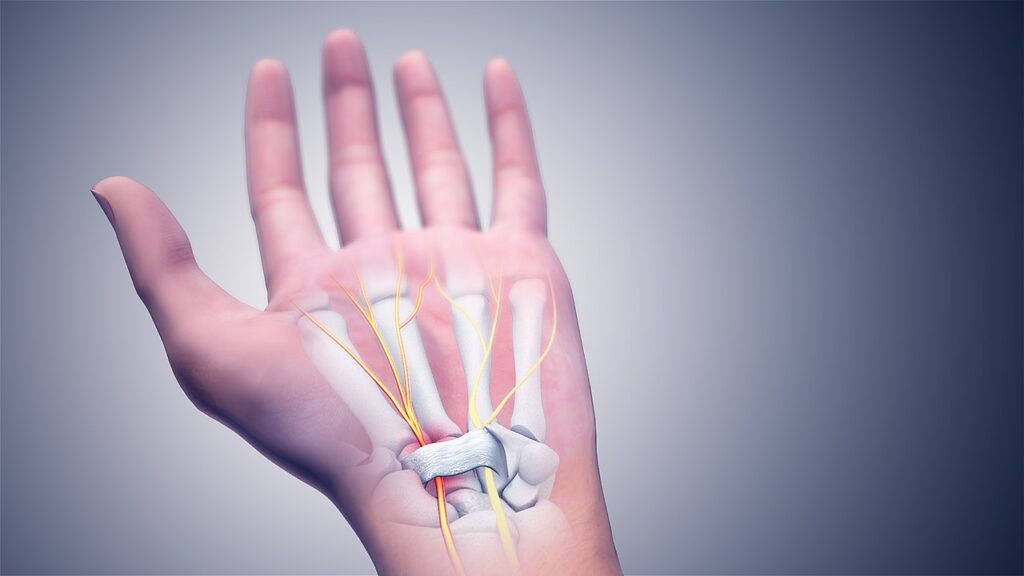 Chiropractic Care For Carpal Tunnel Syndrome in Chicago