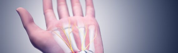 Chiropractic Care For Carpal Tunnel Syndrome in Chicago