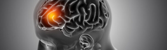 How Chiropractic Care Can Help a Traumatic Brain Injury in Chicago