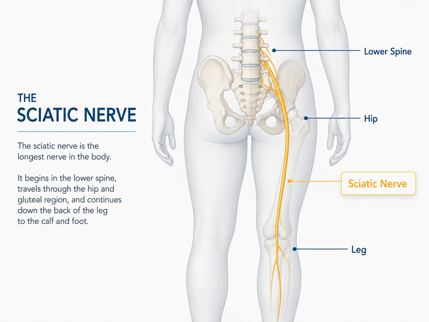Anatomical diagram showing the sciatic nerve pathway from the lower spine through the hip and down the leg